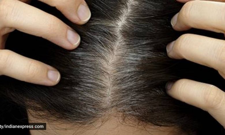 premature greying, how to reverse premature greying of hair, ways to reduce premature greying of hair, easy tips to have black hair, grey hair, tips to reverse grey hair, indianexpress.com, indianexpress,