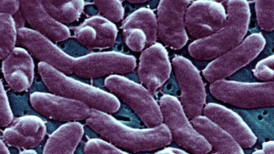 After Hurricane Ian's Floods, the Flesh-Eating Bacteria