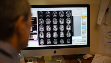 Alzheimer's drug lecanemab slows cognitive decline in dementia fight