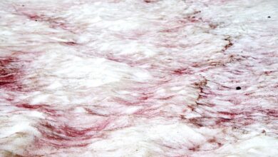 Pink Snow Is Not a Cute Phenomenon—Here’s Why