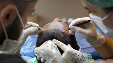 Is hair transplant treatment safe Myths Truth Causes Causes Guidelines and Health Risks